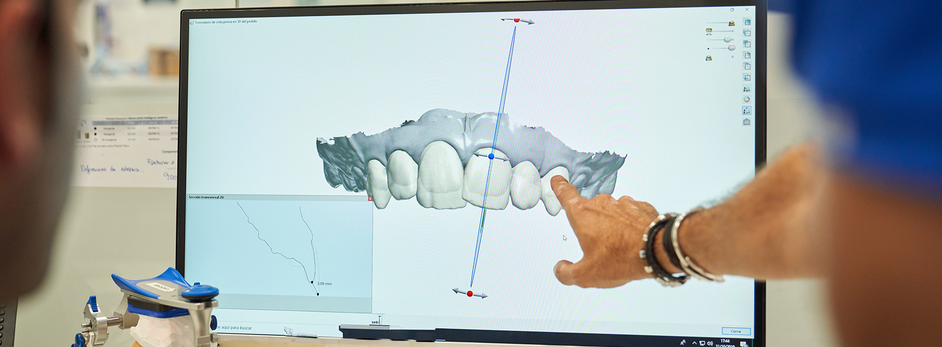 A person s hand pointing at an image on a computer screen displaying a 3D model of a human jaw with teeth, set against a background showing a person working at a desk.
