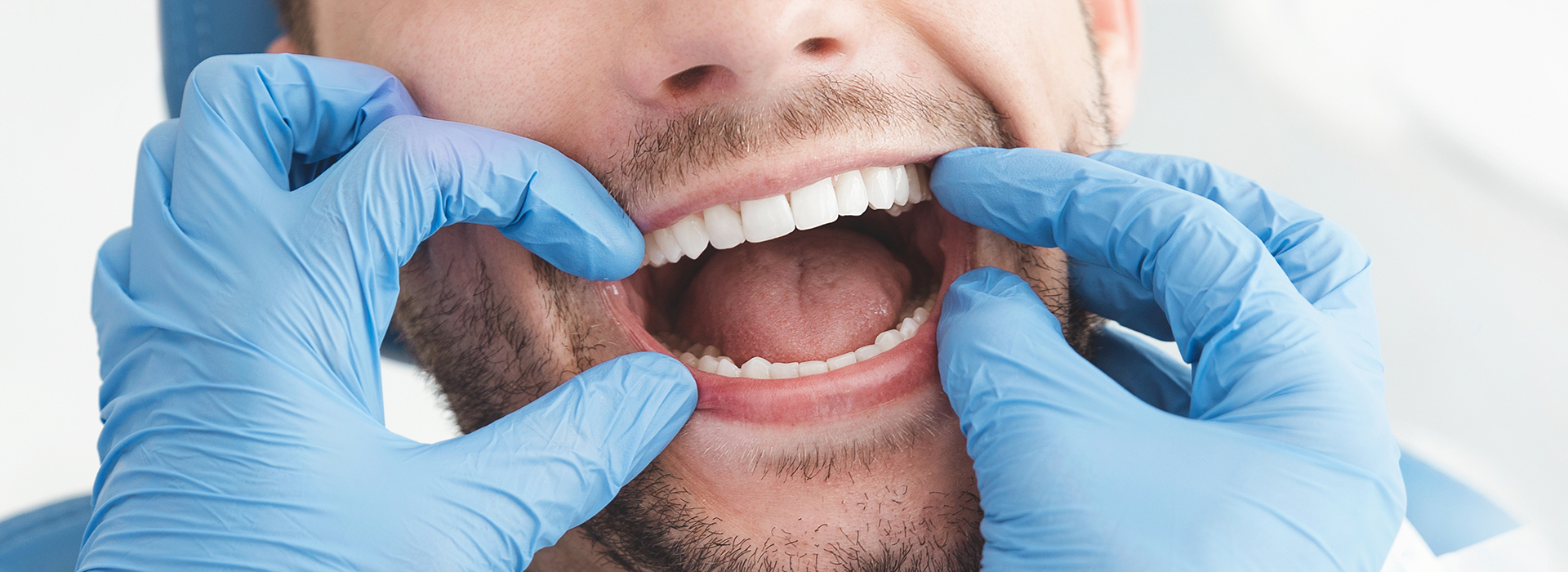 The image shows a man sitting in a dental chair with his mouth open, wearing blue gloves, and holding a mirror to his face.